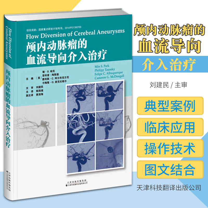 颅内动脉瘤的血流导向介入治疗 刘建民 主审 天津科技翻译出版公司 9787543341272 血流导向的理论基础 血流导向装置的药物治疗