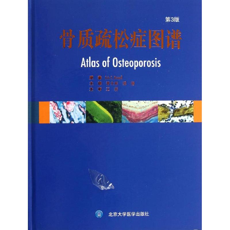 asy 骨质疏松症图谱 (波)奥尔沃；晋大祥,梁德  9787565906633 北京大学医学出版社