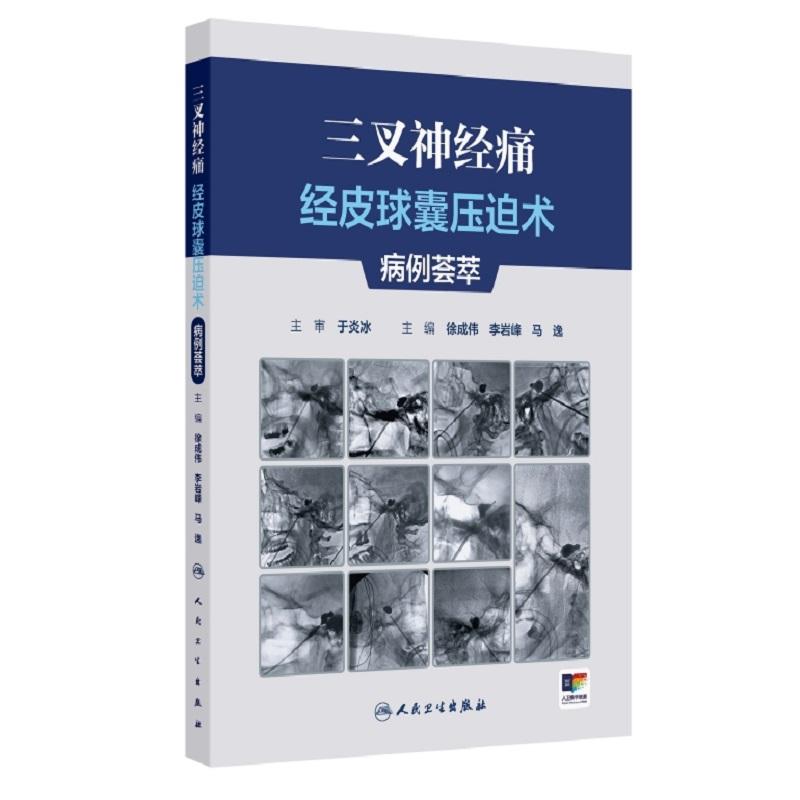 三叉神经痛经皮球囊压迫术病例荟萃 9787117392068 人民卫生出版社 系统阐述三叉神经痛治疗的历史、病因、发病机制等内容