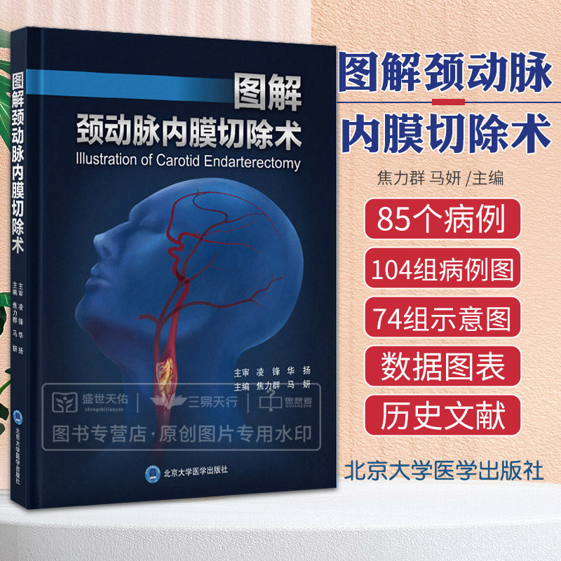 图解颈动脉内膜切除术 焦力群 马妍 神经外科学脑血运重建颈部动脉切除CEA临床检查手术介入治疗图谱动脉狭窄