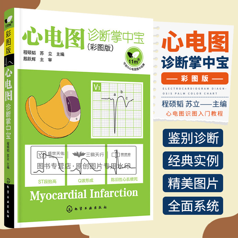 正版心电图诊断掌中宝彩图版苏立心电图图形各种波段识别测量临床医师看心电图方法技巧临床心电图诊断心电图识图图书心电图解