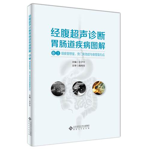 asy 经腹超声诊断胃肠道疾病图解（卷3咽食管憩室、贲门失弛症与食管裂孔疝） 王子干 主编；隋秀芳 主审 9787566424921