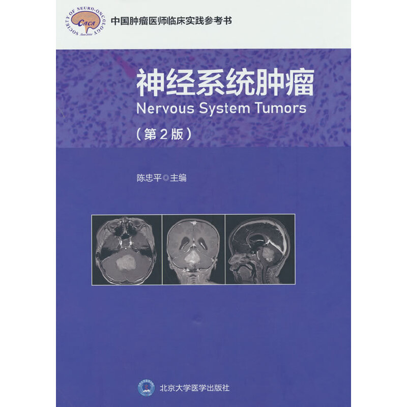 asy 神经系统肿瘤(第2版)(中国肿瘤医师临床实践指南丛书) 编者:陈忠平 9787565927942 北京大学医学