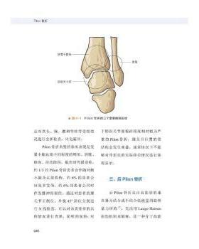 asy Pilon骨折 李钊伟，李泽清 9787523600986 中国科学技术出版社