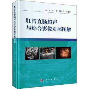 责编 社 编者 科学出版 9787030686060 郭威 郑建军 蒋天安 殷骅 肛管直肠超声与综合影像对照图解 asy