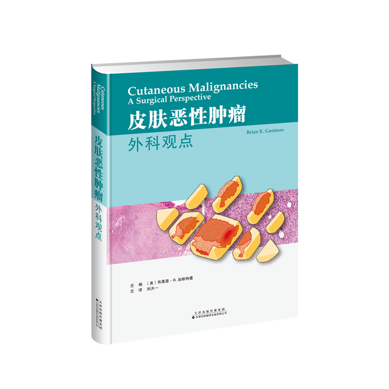 皮肤恶性肿瘤外科观点皮肤病理学皮肤病学肿瘤学临床手术治疗Mohs手术淋巴结活检靶向治疗免疫放射治疗书籍纤维肉瘤血管平滑肌肉瘤