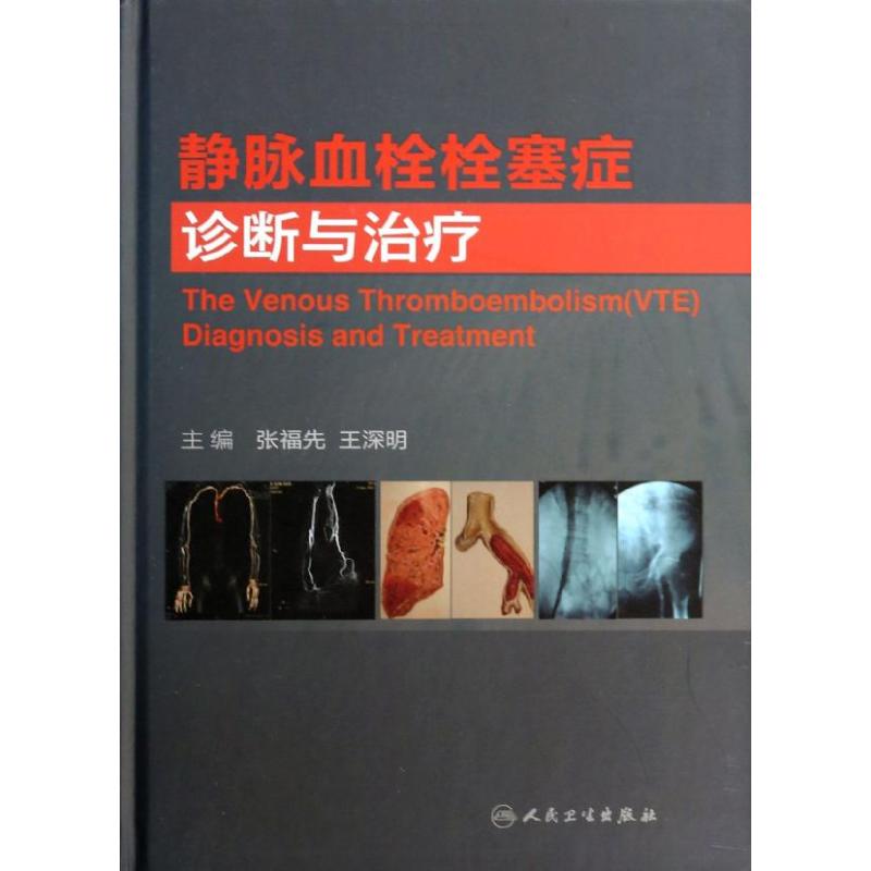 asy 静脉血栓栓塞症诊断与治疗 无 9787117180627 人民卫生出版社
