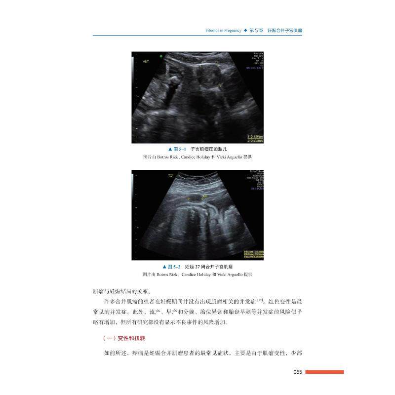 asy 子宫肌瘤与生殖 (埃及)博特罗斯·R.M.B.里兹克 等 9787504691521 中国科学技术出版社