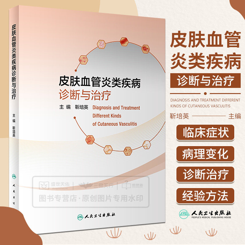 皮肤血管炎类疾病诊断与治疗