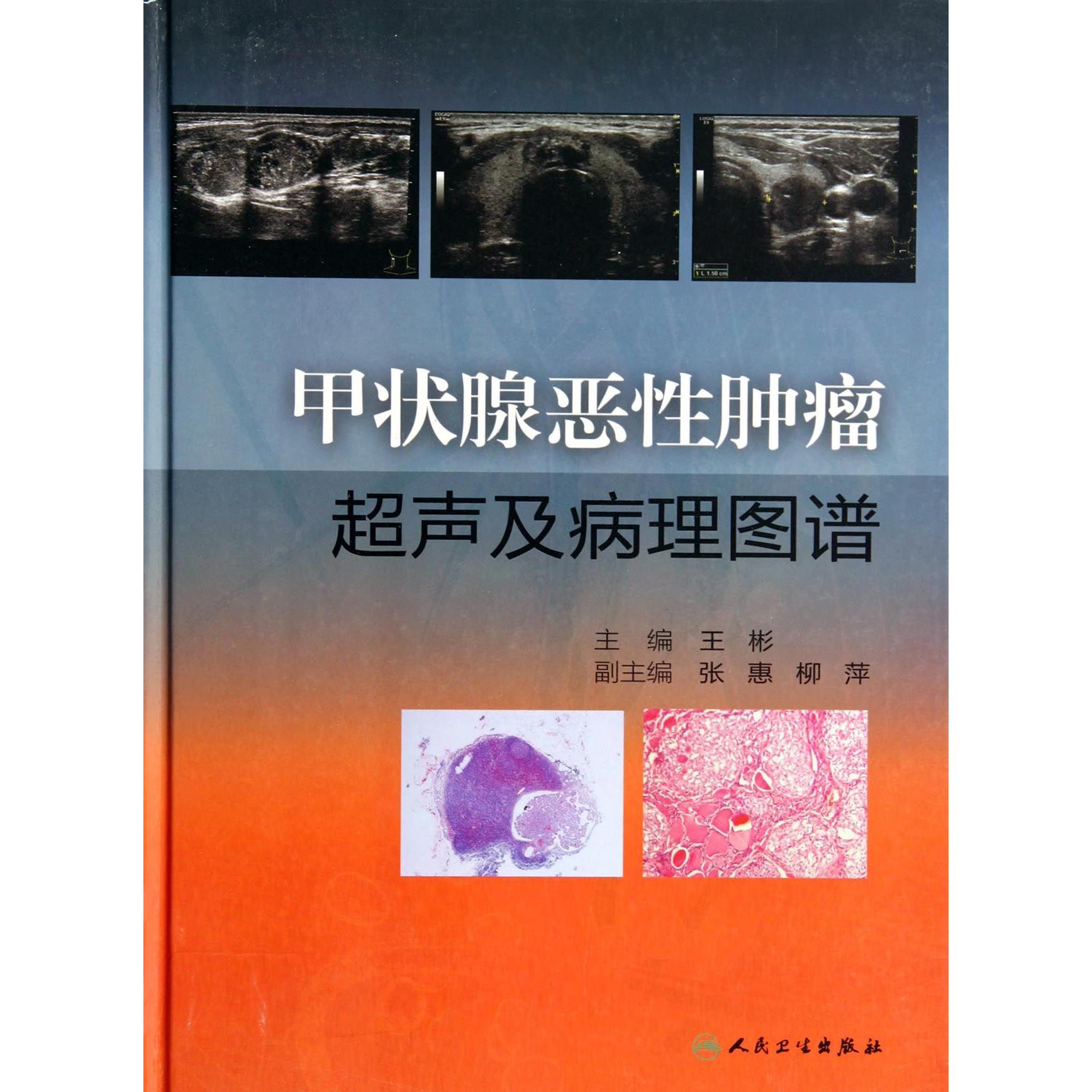 asy 甲状腺恶性肿瘤超声及病理图谱(精) 王彬 9787117186445 人民卫生
