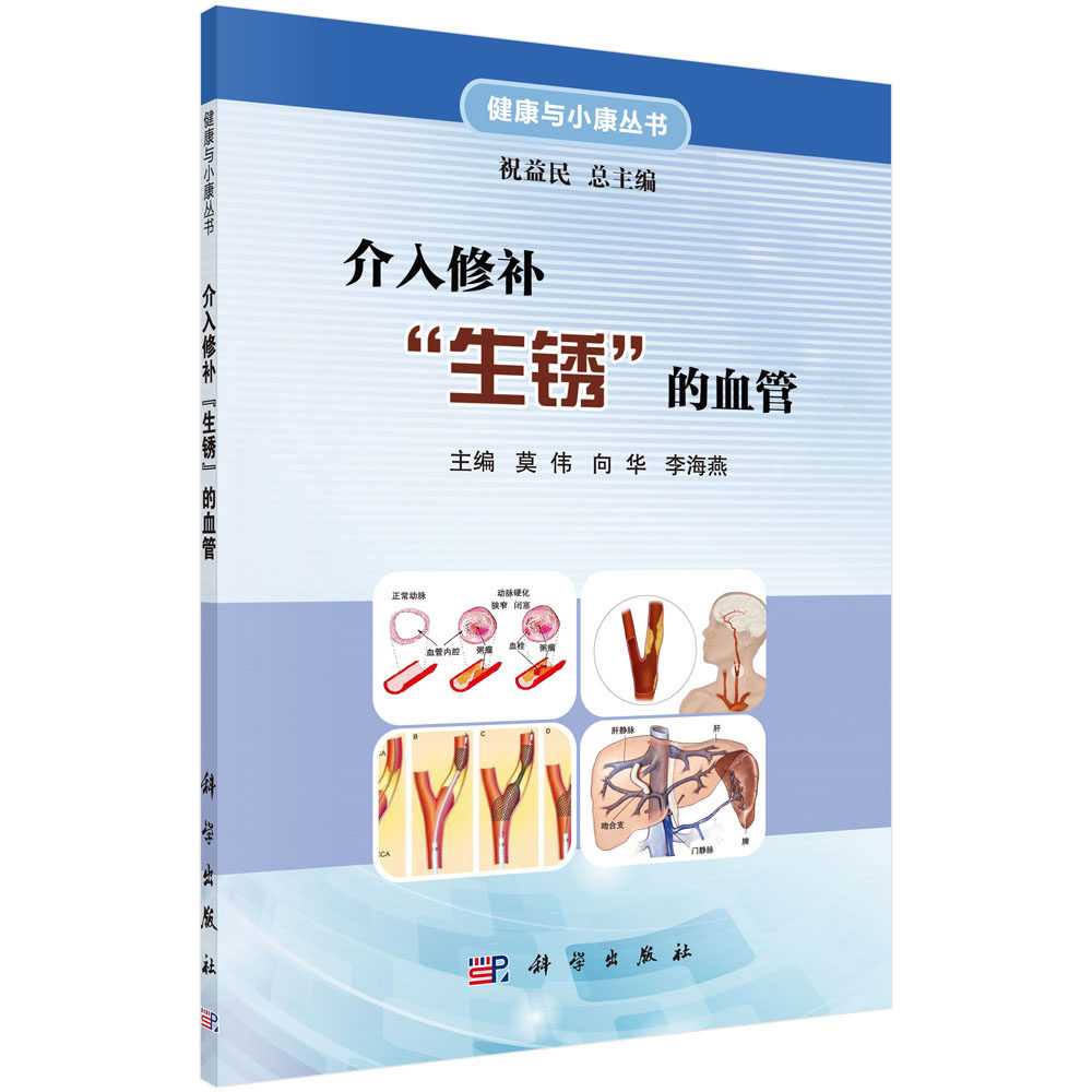 介入修补生锈的血管 健康与小康丛书 莫伟 向华 李海燕主编 2018年11月出版 版次1 平装 科学出版社