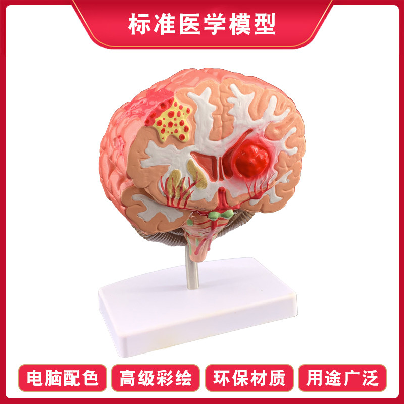 인체 장기 해부학 모델 뇌 구조 계층 모듈 병원 학교 교육 데모 장식품 분리 가능