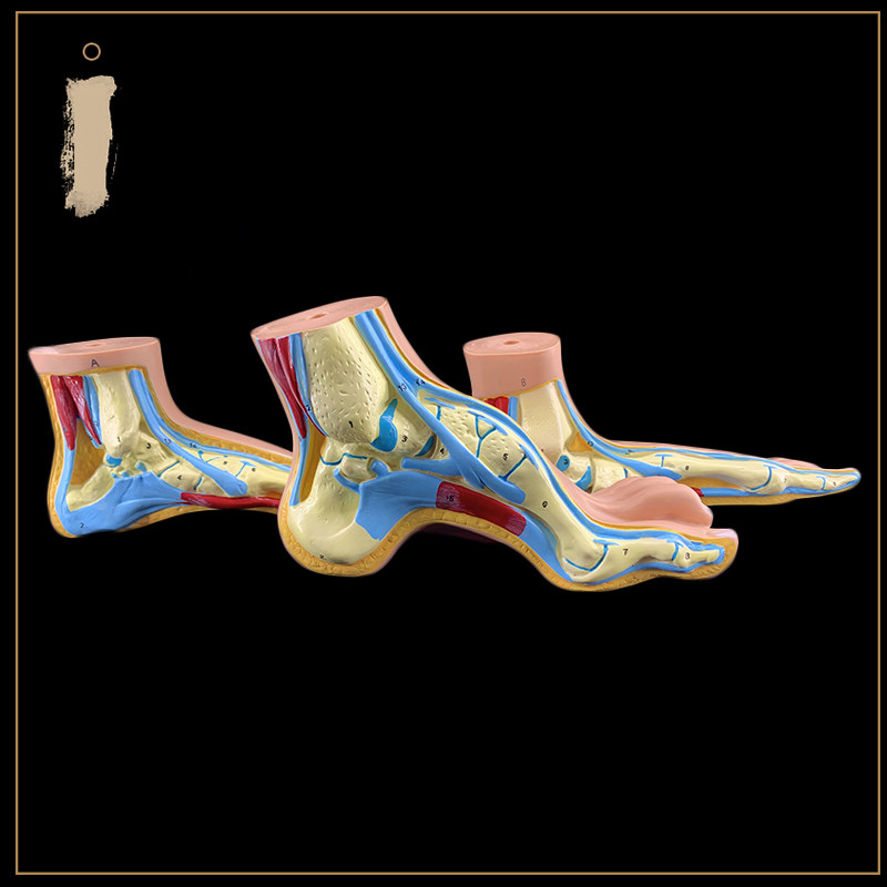 일반 아치 발 높은 아치 발 모델 발 관절 모델 발톱 발 발 모델 해부학 병원