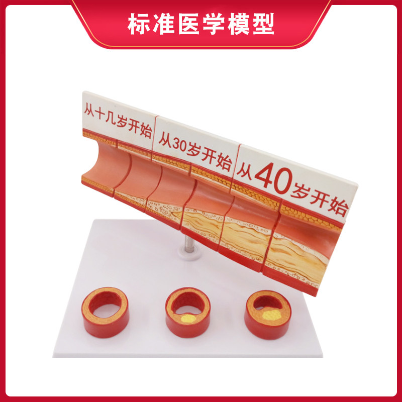인간 혈관 모델 동맥 혈관 방해 변경 데모 교육 모델 장기 해부학 구조 계층 모델