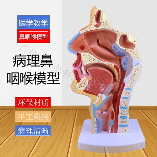 口鼻腔解剖模型腺样体肥大鼻咽喉
