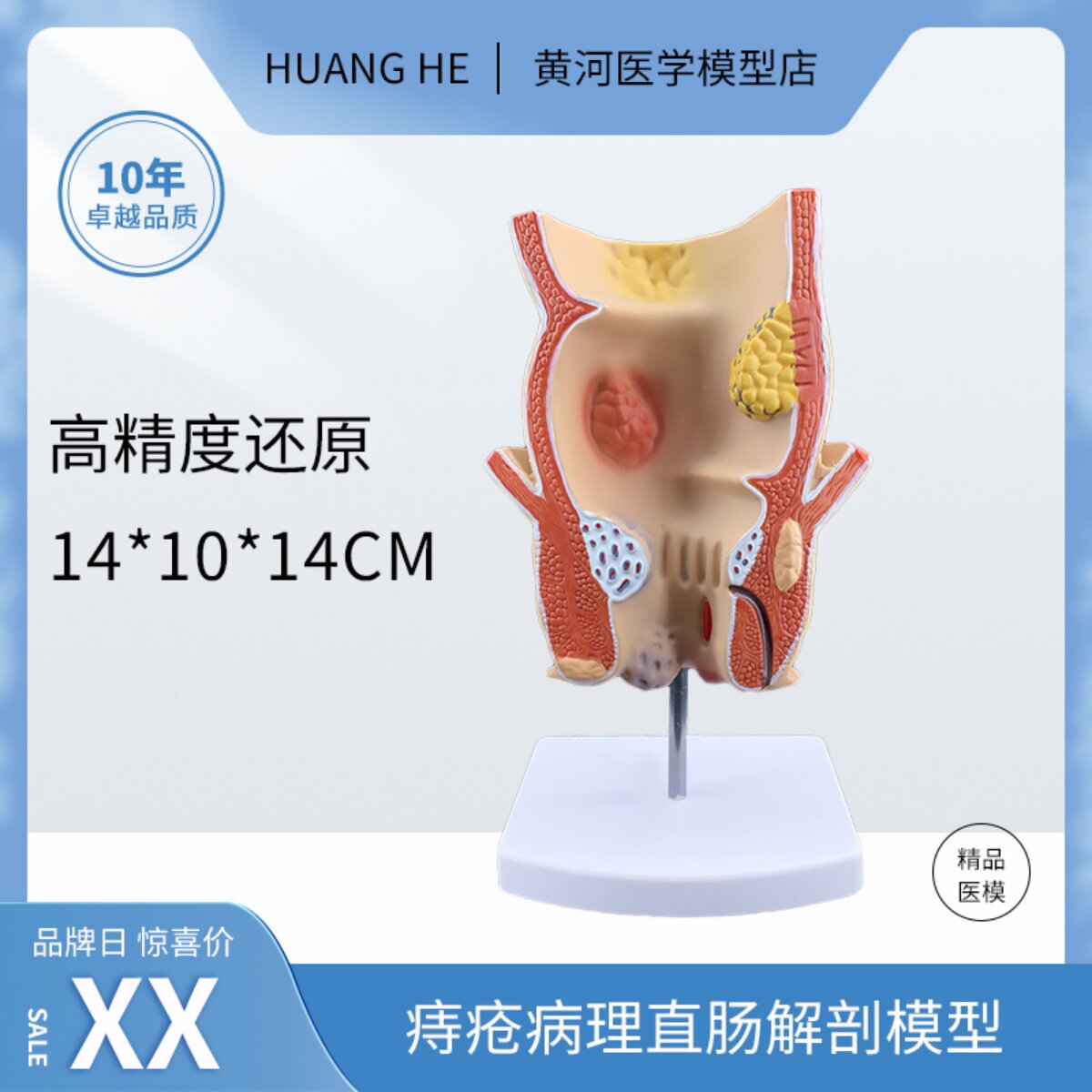 치질 직장 병리학 모델 궤양성 결장 질환 장 해부학 및 병리학 모델 병리학 질환 교육 보조 장치