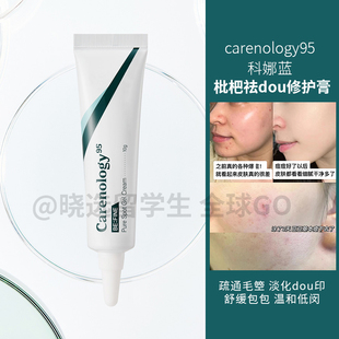 韩国carenology95科娜蓝枇杷修护祛dou膏霜淡化豆印滋润修复