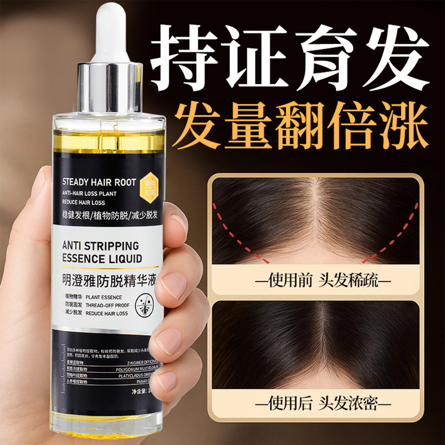 【持证育发】防脱育发液生发增发密发剂侧柏叶生姜营养精华男女