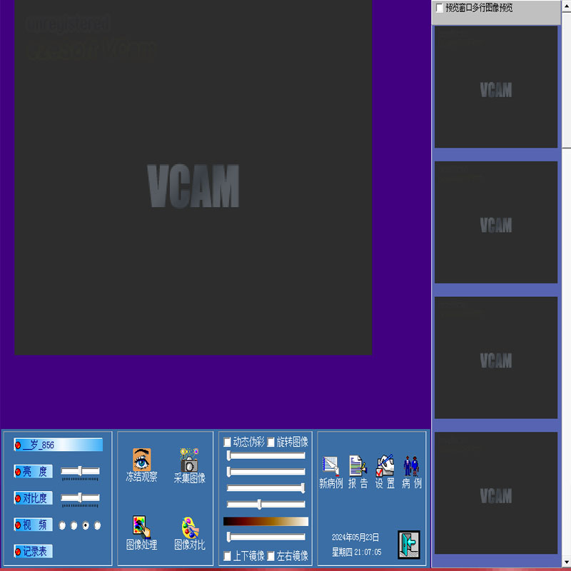 超声报告系统，视频卡+报告软件+脚踏板+视频连接线