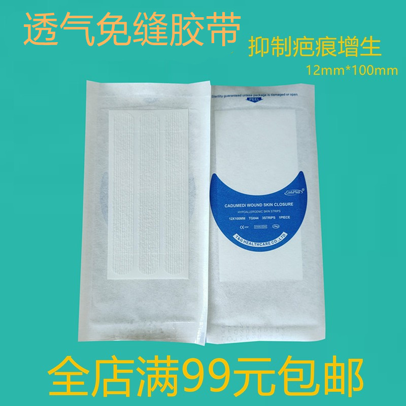 透气无纺布敷料免缝胶带减张贴