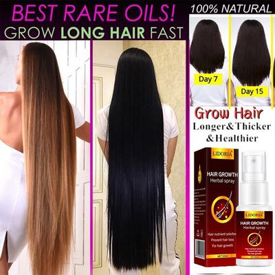 Ginger Hair Growth Essence Spray Anti Hair Loss Products Eff