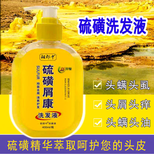硫磺洗发水去屑止痒控油痘痘