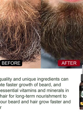 BeardGrowthSpray型男胡子精华
