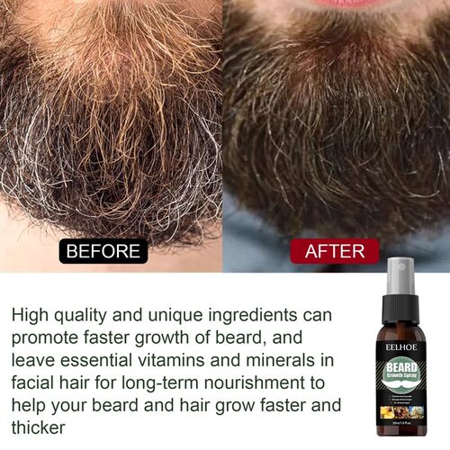 BeardGrowthSpray型男胡子精华