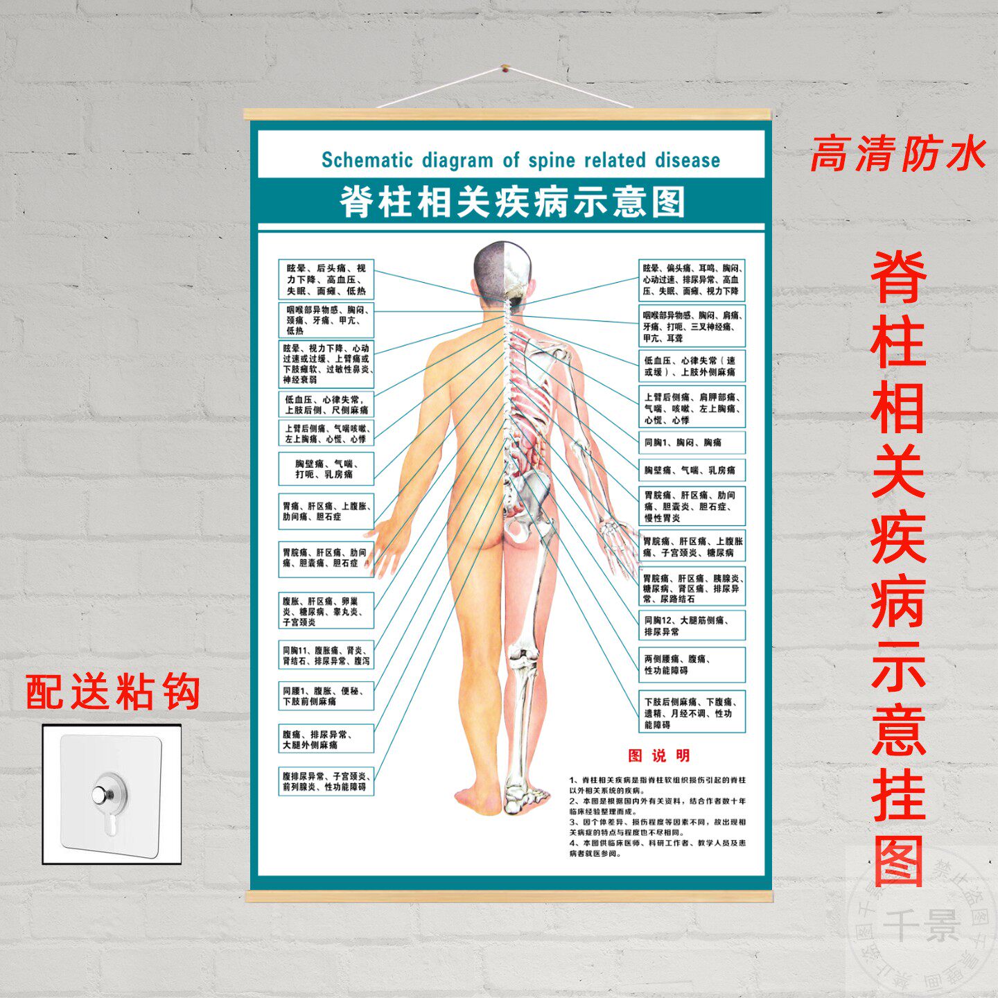 脊椎健康速查图脊柱相关疾病示意图中医养生病理原因结构图挂图