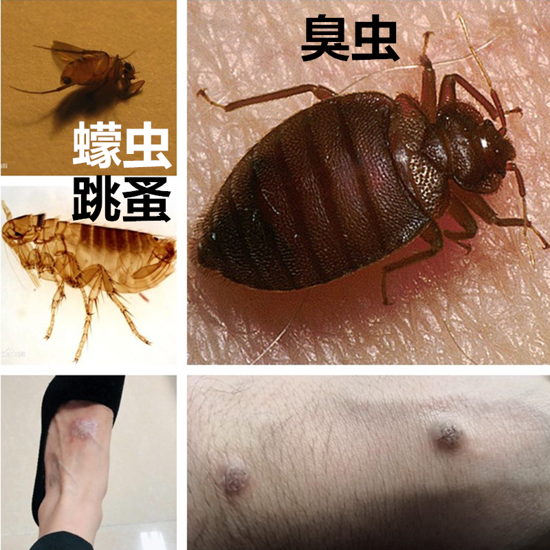 儿童蚊虫叮咬止痒膏蠓虫成人清湿身痒毒蚊子臭虫跳蚤