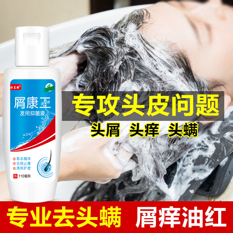屑康王去屑止痒洗发水去头屑毛囊儿童除螨洗头膏抑菌液诗莱格正品