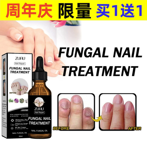 Gray nail repair solution, new shiny nail groove, Yan herba