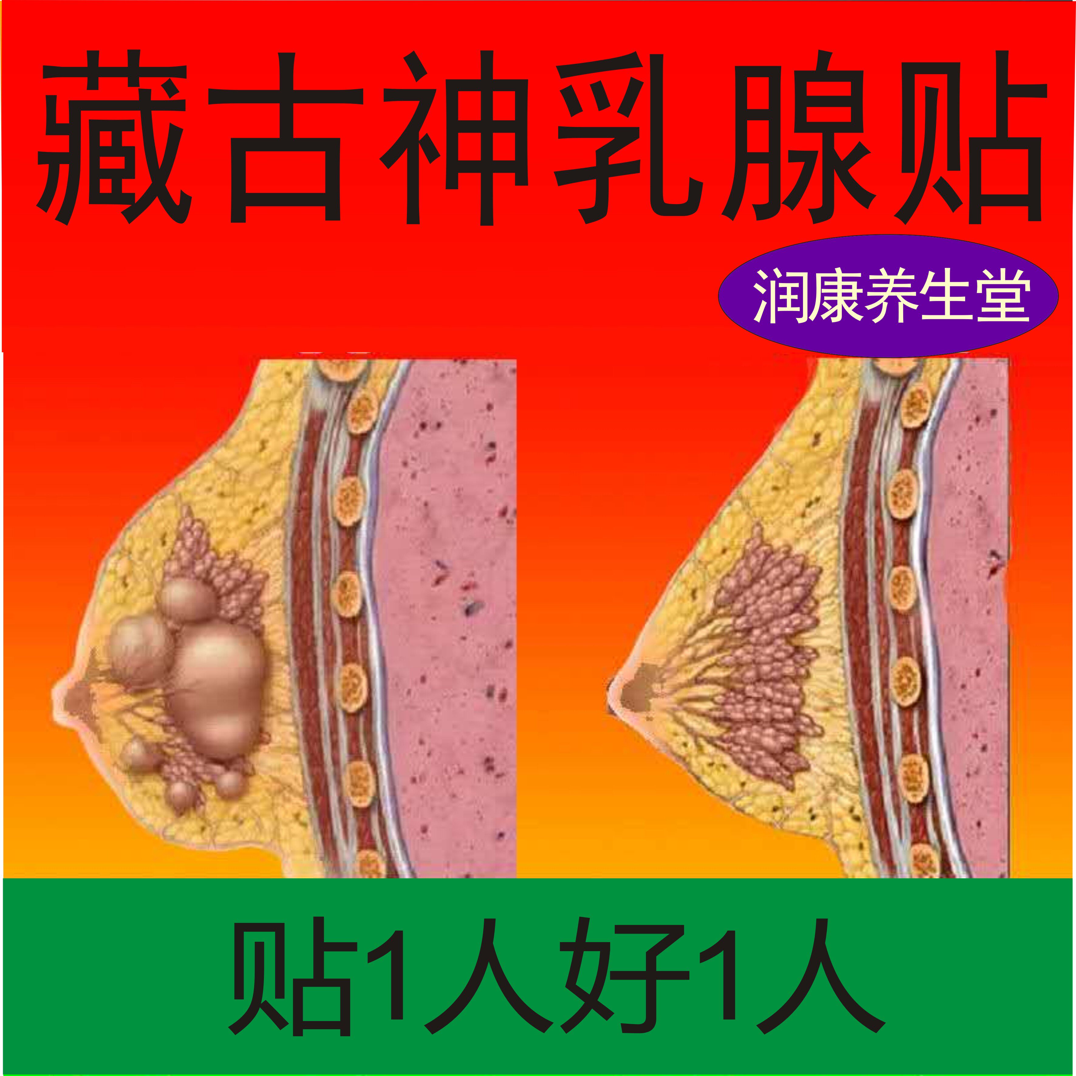 藏古神牌乳腺贴乳安康疏通乳消安贴