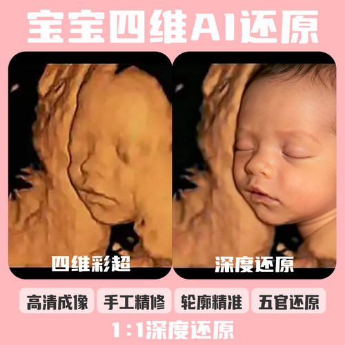 宝宝四维ai照片三维五维四维彩超还原预测胎儿长相高清婴儿成像
