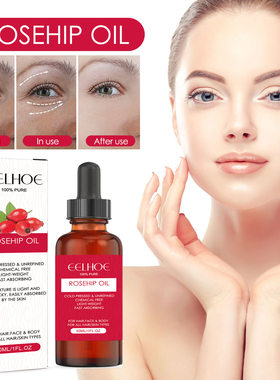 Rose Hip Facial Oil Face Body Moisturising Skin Smoothing Ha