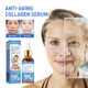Anti Fine Wrinkle Aging Collagen Facial Serum Fade Line