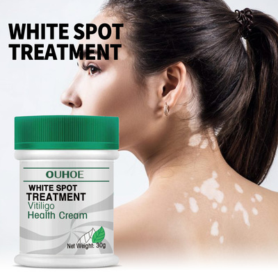 White Spot Repair Cream Repair and Lighten White Spots Spots