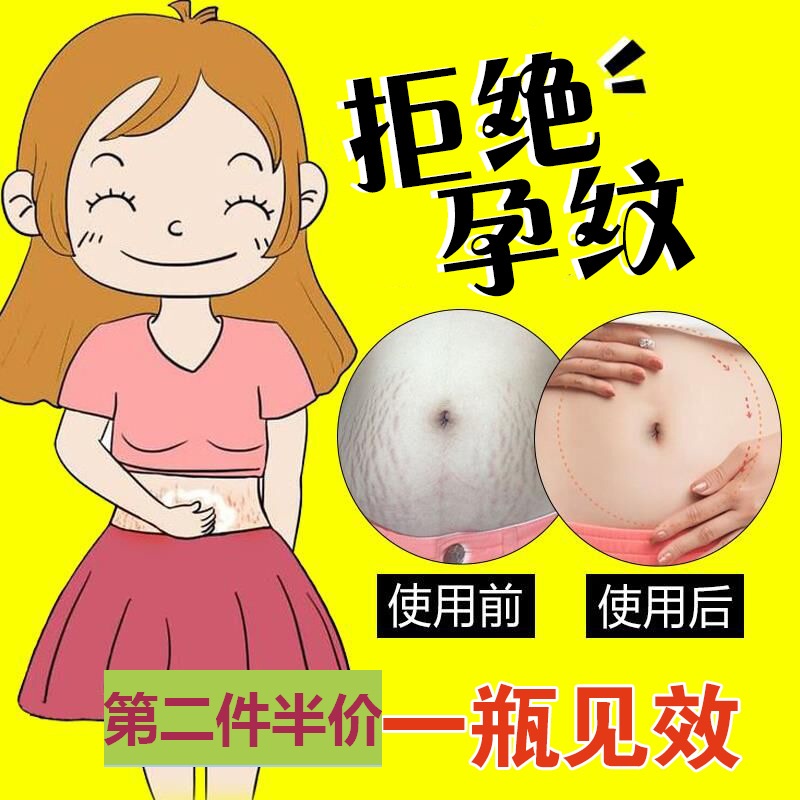 [SOSO美容护肤身体乳,霜]去妊纹去妊娠纹产后消除修复霜肥胖纹预月销量4件仅售56元