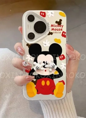 卡通害羞手机保护壳风100Pro300X30iins米奇荣耀捂脸女款适用X30