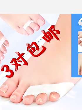 保护套重叠趾分离外翻矫正器