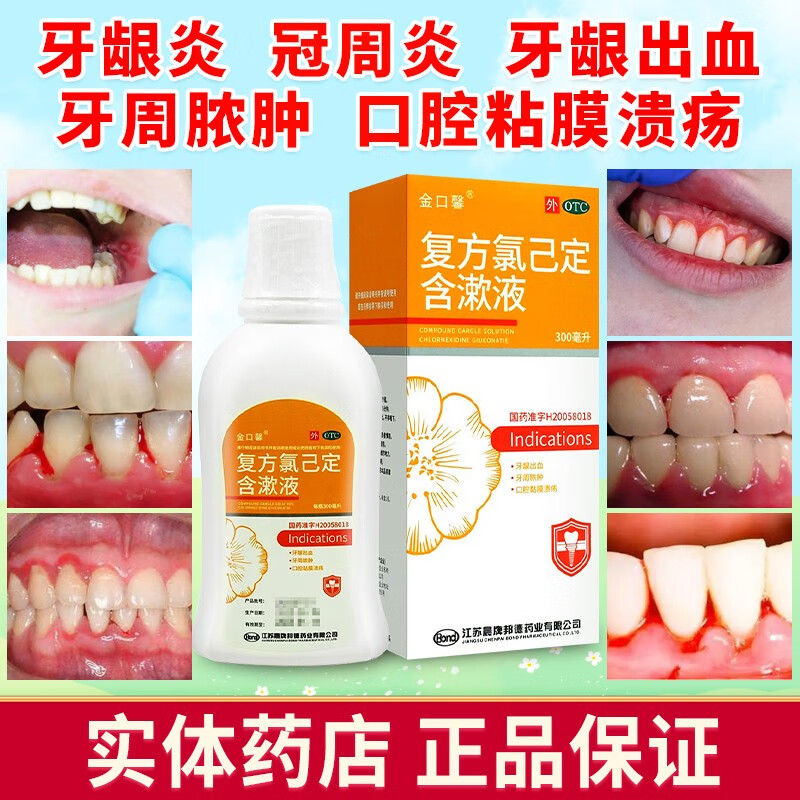 【金口馨】复方氯己定含漱液1.2mg0.2mg*300ml/盒氯已定漱口水