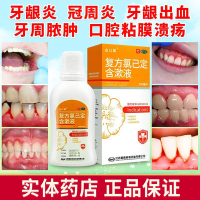 [金口馨]复方氯己定含漱液0.02%0.12%*300ml*1瓶/盒氯已定漱口水