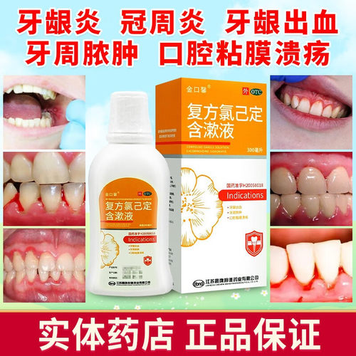 【金口馨】复方氯己定含漱液0.02%0.12%*300ml*1瓶/盒氯已定漱口水