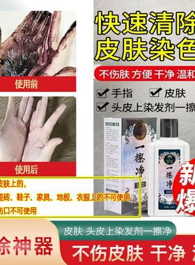 污渍一擦净去除染发剂膏的清洁剂皮肤染发膏清除剂专用药水
