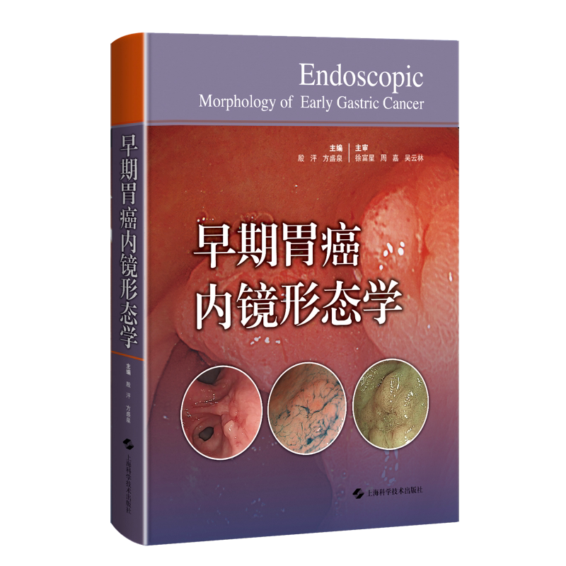 早期胃癌内镜形态学影像医学