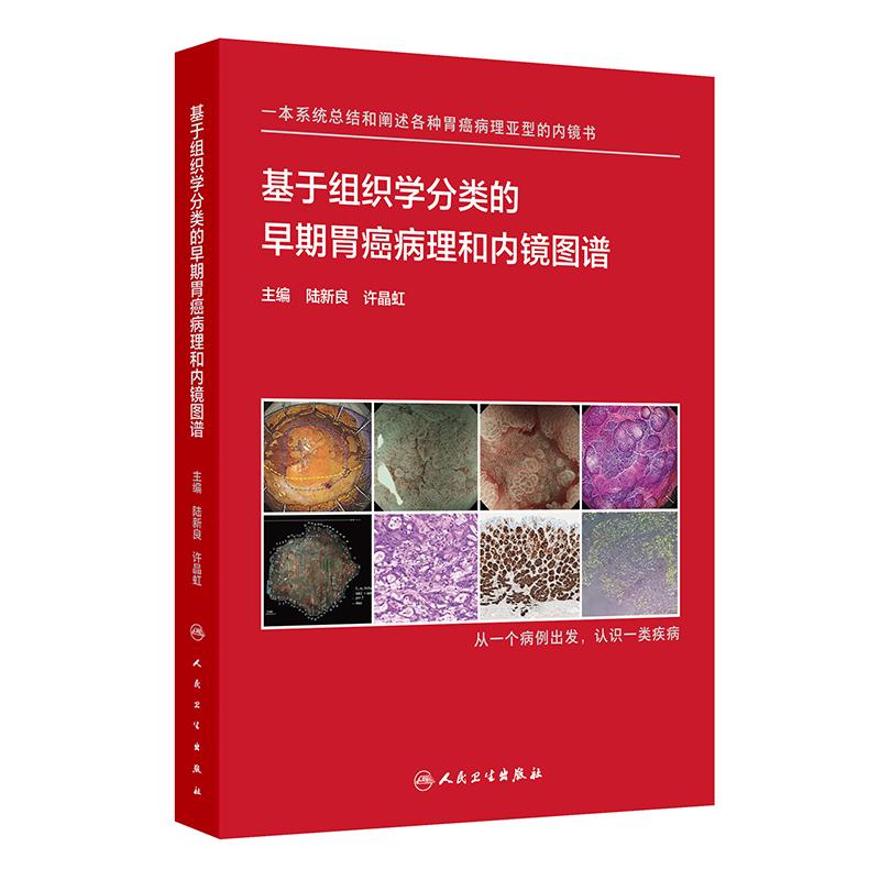基于组织学分类的早期胃癌病理和内镜图谱 陆新良 许晶虹 系统阐述各种病理亚型早期胃癌内镜病理特征9787117366021人民卫生出版社
