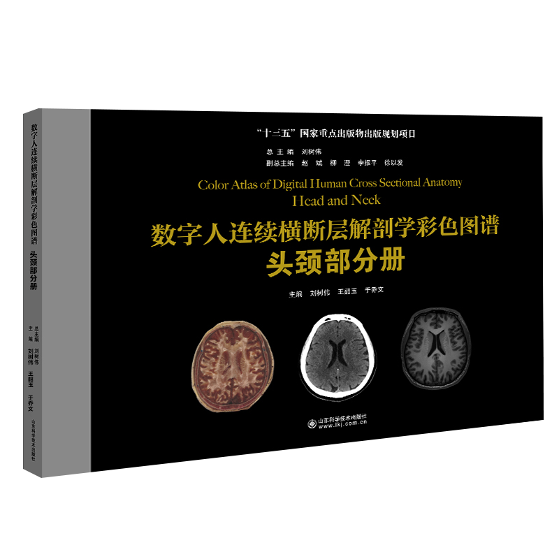 数字人连续横断层解剖学彩色图谱头颈部分册 CT MR 图像 头皮 颅顶骨 蛛网膜粒 眶下部 鼻腔与鼻旁窦 眶下部 鼻腔与鼻旁窦
