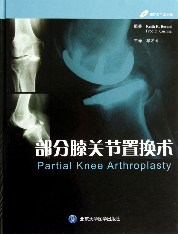 部分膝关节置换术 (美)贝伦德,(美)库什纳 正版书籍   博库网