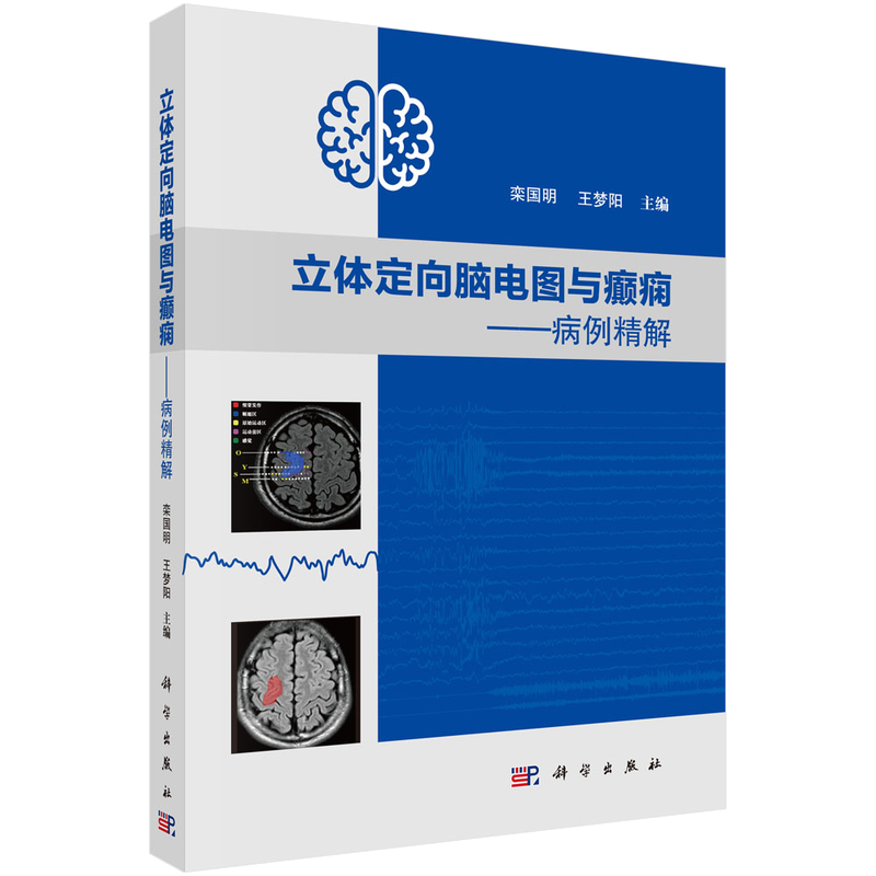 立体定向脑电图与癫痫:病例精解 博库网
