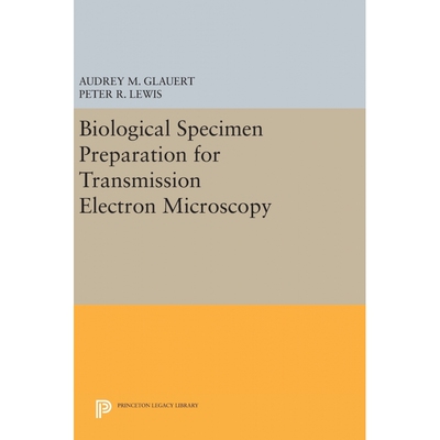 Biological Specimen Preparation for Transmission Electron Mi
